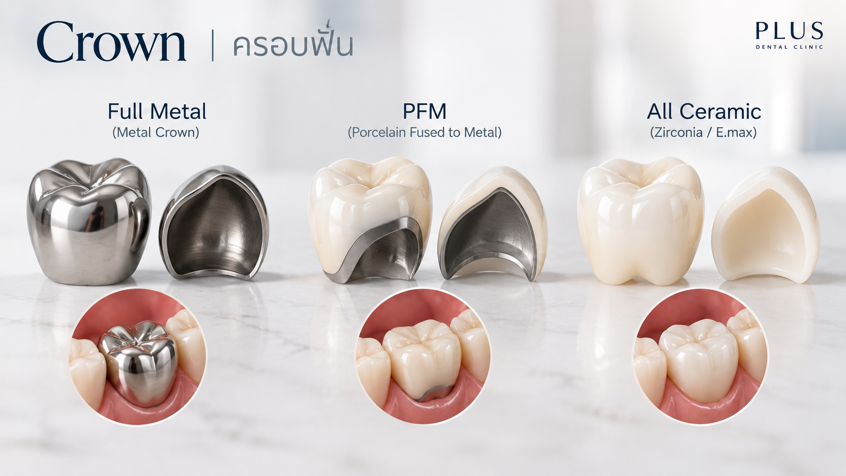 การใช้แบบจำลองประกอบการเปรียบเทียบทางเลือก